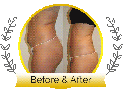 Before After Image